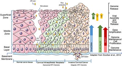 Histone Deacetylase Inhibitors as Therapeutic Interventions on Cervical Cancer Induced by Human Papillomavirus